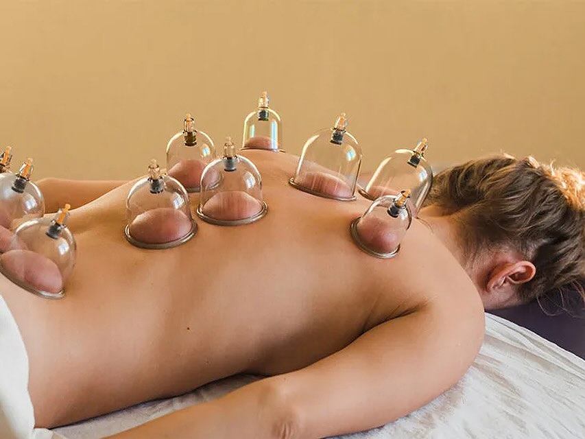 Cupping therapy treatment - traditional suction cup healing therapy